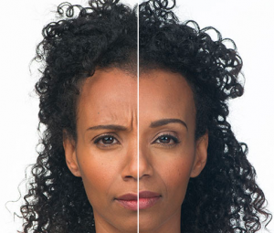 Image Allergan Before and After