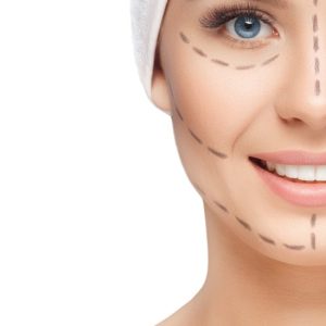 Smile lines: a non-surgical lift